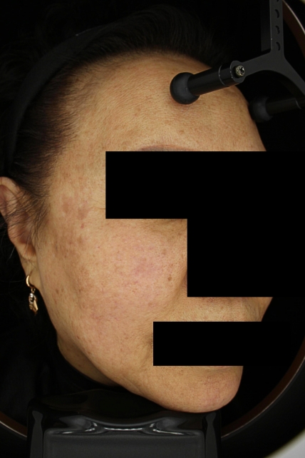 치료후기 이미지