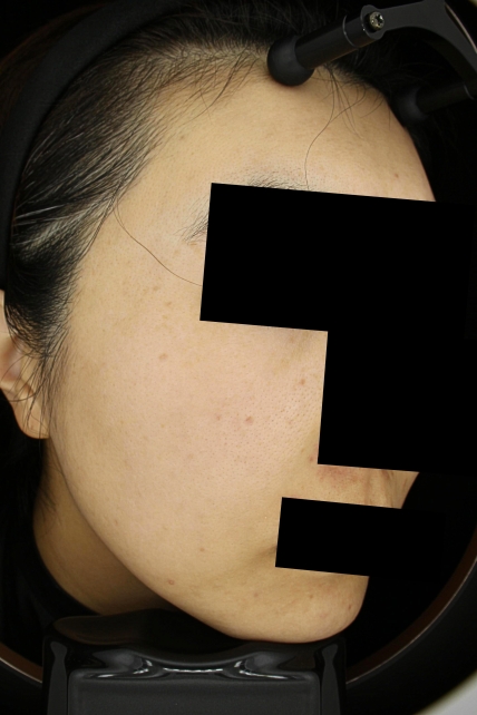 치료후기 이미지