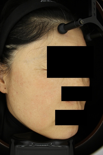 치료후기 이미지