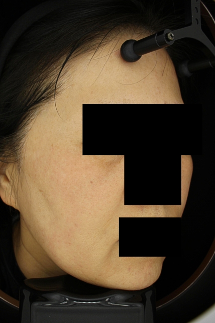 치료후기 이미지