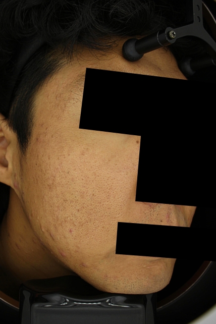 치료후기 이미지