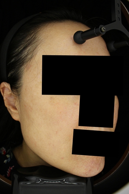 치료후기 이미지