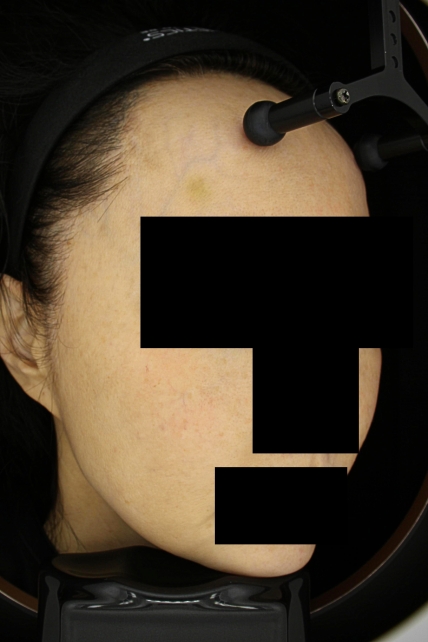 치료후기 이미지