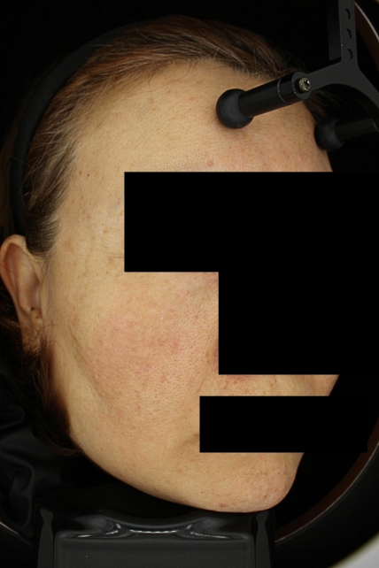 치료후기 이미지