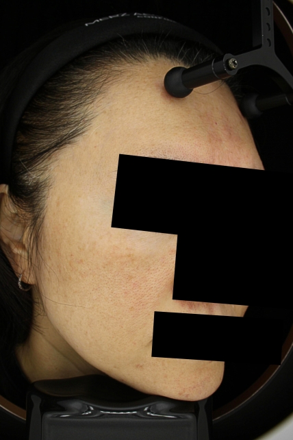 치료후기 이미지