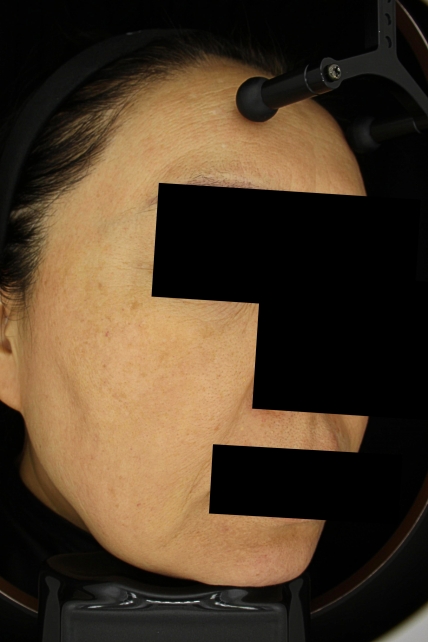 치료후기 이미지