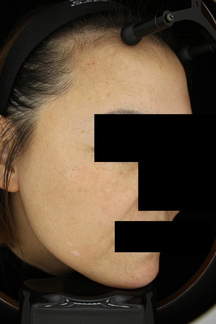 치료후기 이미지