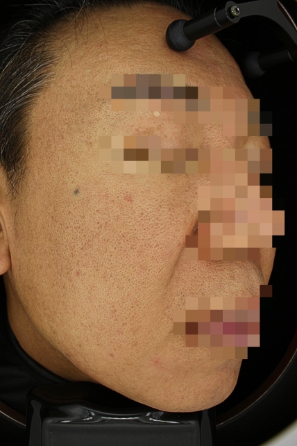 치료후기 이미지