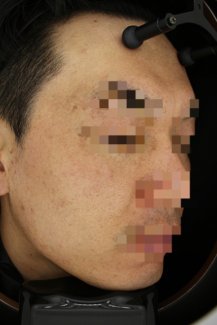 치료후기 이미지