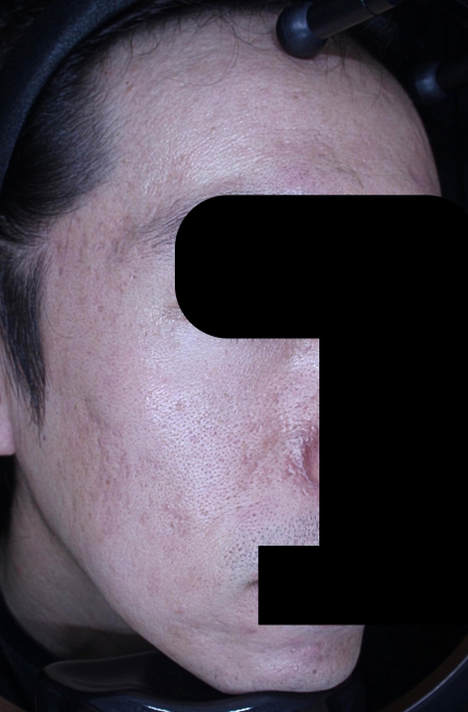 치료후기 이미지