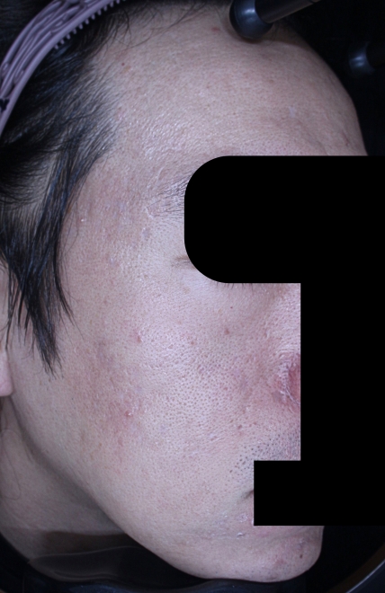 치료후기 이미지