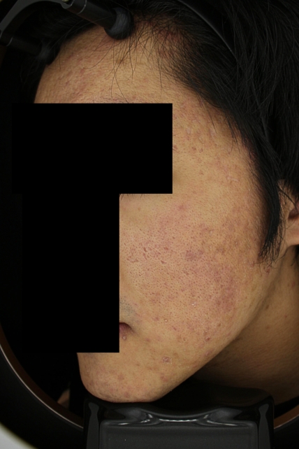 치료후기 이미지