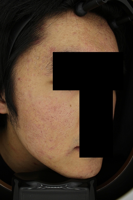 치료후기 이미지