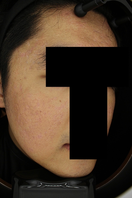 치료후기 이미지