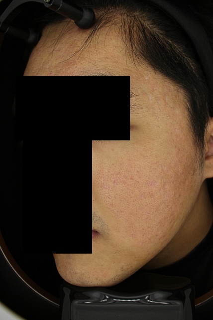 치료후기 이미지