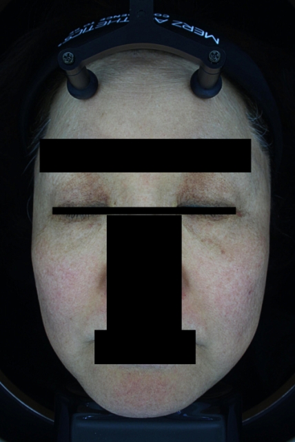 치료후기 이미지