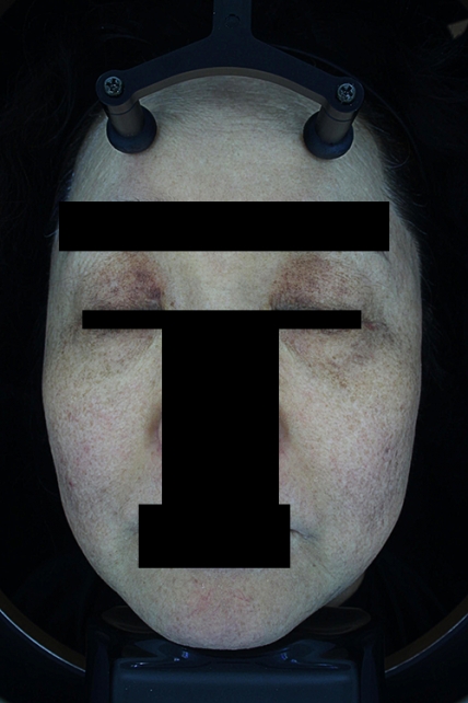 치료후기 이미지