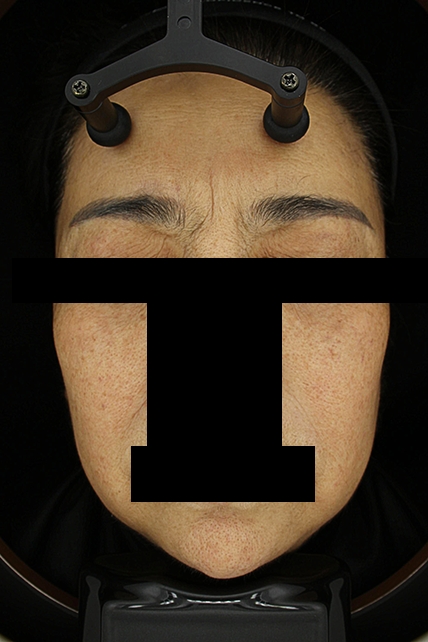 치료후기 이미지