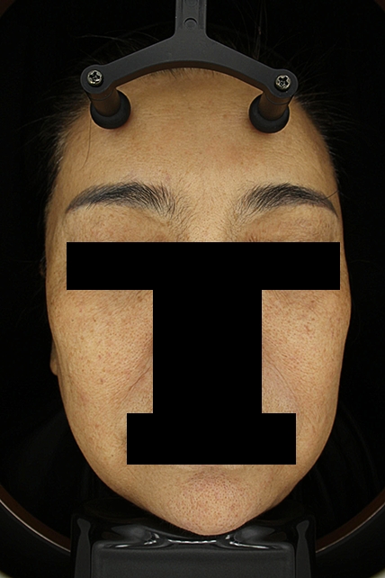 치료후기 이미지