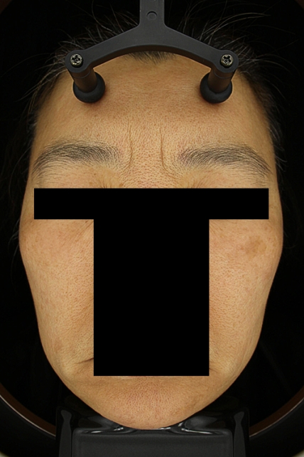 치료후기 이미지