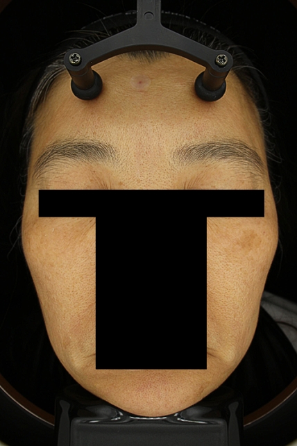 치료후기 이미지