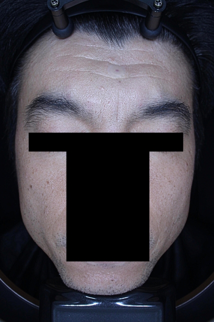 치료후기 이미지