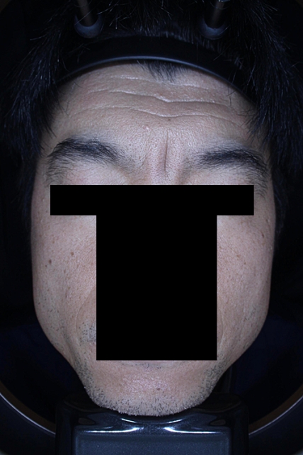 치료후기 이미지