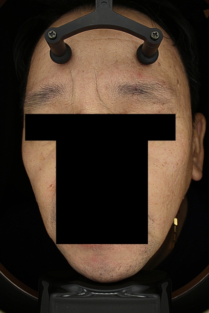 치료후기 이미지