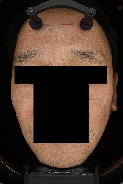 치료후기 이미지