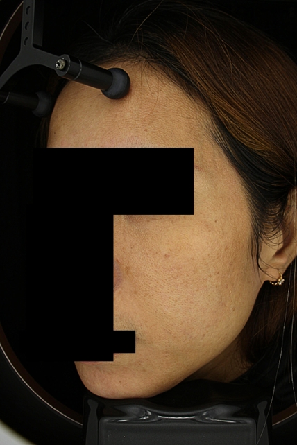 치료후기 이미지