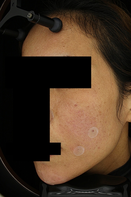 치료후기 이미지