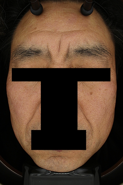 치료후기 이미지