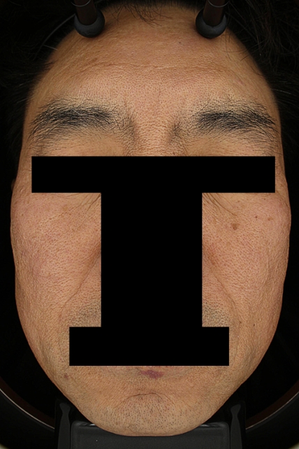 치료후기 이미지