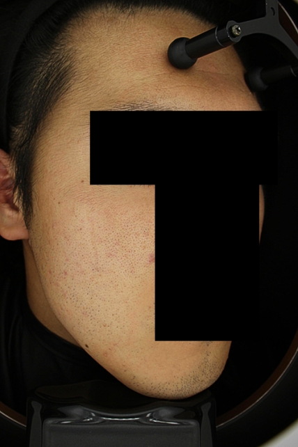 치료후기 이미지