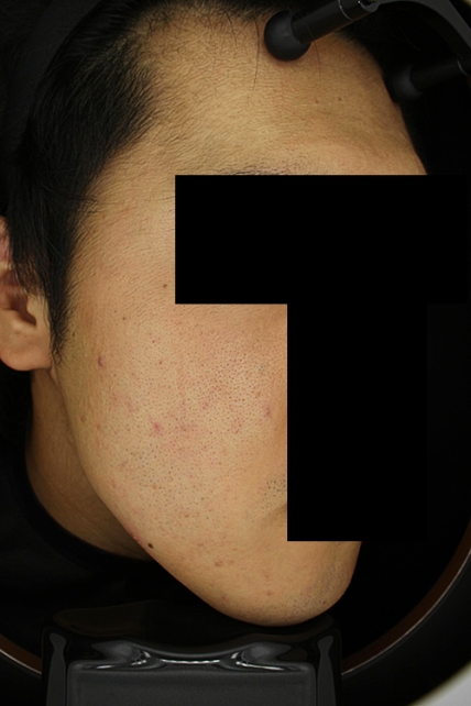 치료후기 이미지