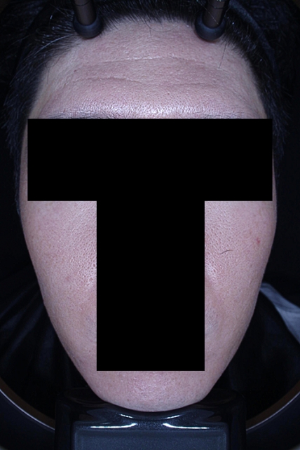 치료후기 이미지