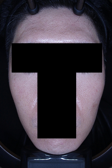 치료후기 이미지