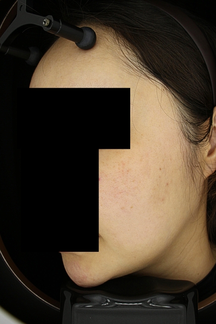 치료후기 이미지