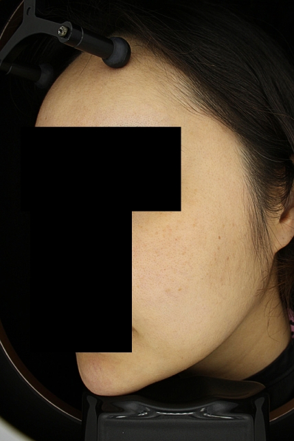 치료후기 이미지