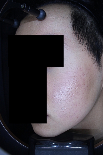 치료후기 이미지