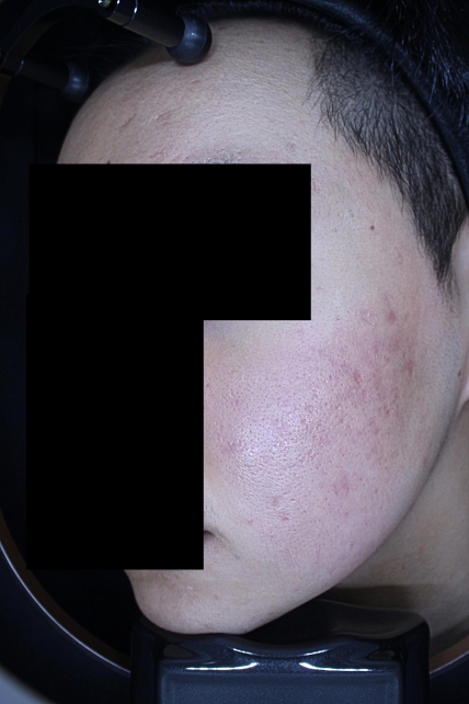 치료후기 이미지