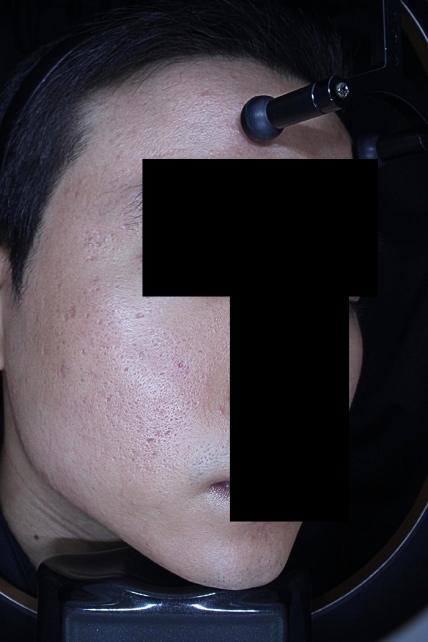 치료후기 이미지