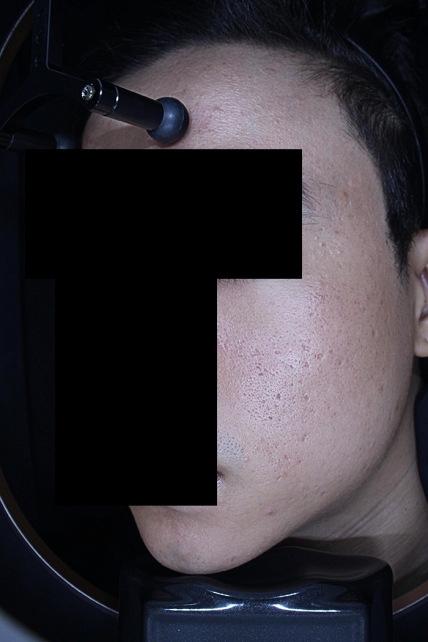 치료후기 이미지