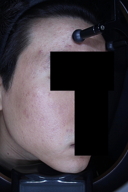 치료후기 이미지