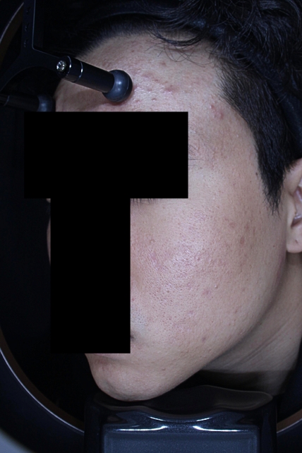 치료후기 이미지