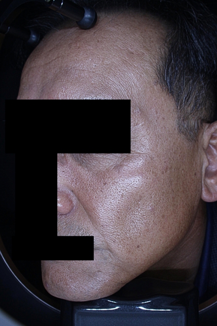 치료후기 이미지