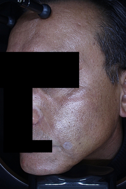 치료후기 이미지