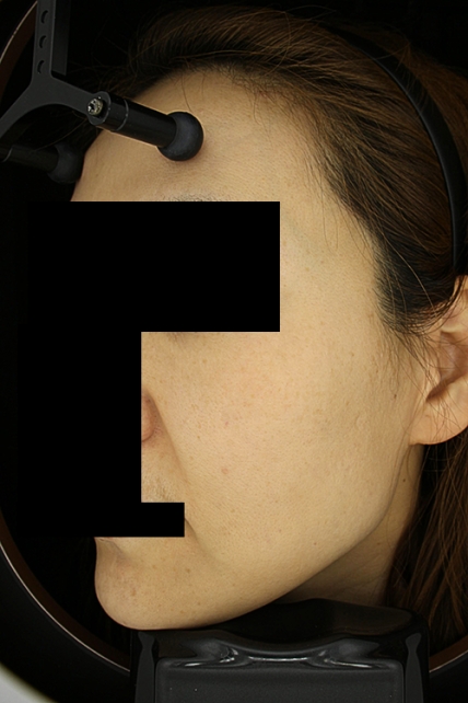 치료후기 이미지