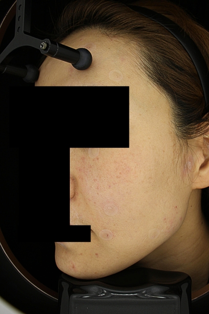 치료후기 이미지