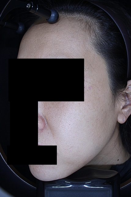 치료후기 이미지